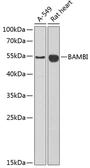Anti-BAMBI antibody used in Western Blot (WB). GTX64625