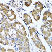 Anti-HYAL1 antibody used in IHC (Paraffin sections) (IHC-P). GTX64626