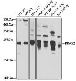 Anti-TC21 antibody used in Western Blot (WB). GTX64628