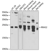 Anti-TC21 antibody used in Western Blot (WB). GTX64628