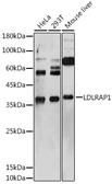 Anti-ARH antibody used in Western Blot (WB). GTX64629