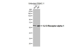 Anti-IL13 Receptor alpha 1 antibody [HL5609] used in Western Blot (WB). GTX646291