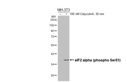 Anti-eIF2 alpha (phospho Ser51) antibody [HL5614] used in Western Blot (WB). GTX646296