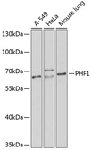 Anti-PHF1 antibody used in Western Blot (WB). GTX64631