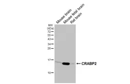 Anti-CRABP2 antibody [HL5622] used in Western Blot (WB). GTX646311