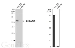 Anti-C16orf62 antibody [HL5629] used in Western Blot (WB). GTX646318