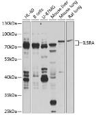 Anti-IL5 Receptor alpha antibody used in Western Blot (WB). GTX64632