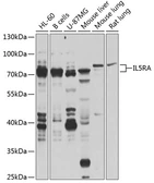 Anti-IL5 Receptor alpha antibody used in Western Blot (WB). GTX64632