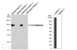 Anti-LI-Cadherin antibody [HL5636] used in Western Blot (WB). GTX646325