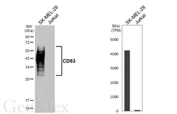Anti-CD63 antibody [GT366] used in Western Blot (WB). GTX646339