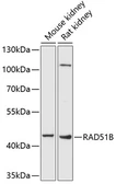 Anti-Rad51B antibody used in Western Blot (WB). GTX64635