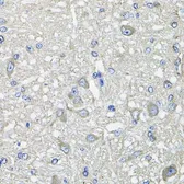 Anti-GFPT1 antibody used in IHC (Paraffin sections) (IHC-P). GTX64638