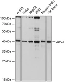 Anti-GIPC1 antibody used in Western Blot (WB). GTX64641