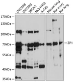 Anti-ZP1 antibody used in Western Blot (WB). GTX64642