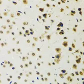 Anti-RUVBL2 antibody used in IHC (Paraffin sections) (IHC-P). GTX64643