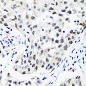 Anti-RUVBL2 antibody used in IHC (Paraffin sections) (IHC-P). GTX64645