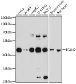 Anti-PHD1 antibody used in Western Blot (WB). GTX64646