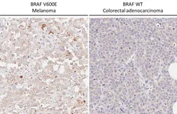 Anti-B-Raf (V600E Mutant) antibody [HL5673] used in IHC (Paraffin sections) (IHC-P). GTX646482