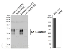 Anti-IL1 Receptor 2 antibody [HL5679] used in Western Blot (WB). GTX646488