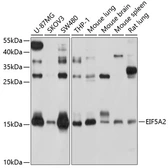 Anti-EIF5A2 antibody used in Western Blot (WB). GTX64649