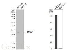 Anti-MTAP antibody [HL5682] used in Western Blot (WB). GTX646491