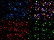 Anti-PNK antibody used in Immunocytochemistry/ Immunofluorescence (ICC/IF). GTX64651