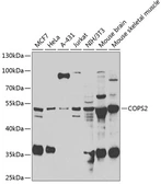 Anti-TRIP15 antibody used in Western Blot (WB). GTX64652