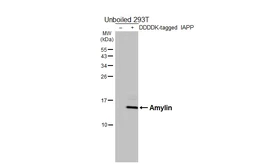 Anti-Amylin antibody [HL5701] used in Western Blot (WB). GTX646532
