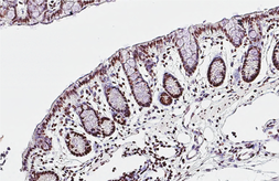 Anti-TDP43 antibody [HL5702] used in IHC (Paraffin sections) (IHC-P). GTX646533