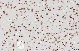 Anti-TDP43 antibody [HL5704] used in IHC (Paraffin sections) (IHC-P). GTX646535