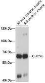 Anti-AChR gamma antibody used in Western Blot (WB). GTX64654