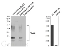 Anti-CD63 antibody [GT368] used in Western Blot (WB). GTX646552