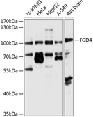 Anti-FGD4 antibody used in Western Blot (WB). GTX64656
