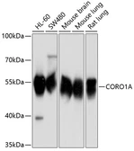 Anti-Coronin 1A antibody used in Western Blot (WB). GTX64657