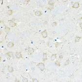 Anti-GIPR antibody used in IHC (Paraffin sections) (IHC-P). GTX64658