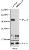 Anti-WSTF antibody used in Western Blot (WB). GTX64663
