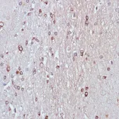 Anti-TPD52 antibody used in IHC (Paraffin sections) (IHC-P). GTX64664