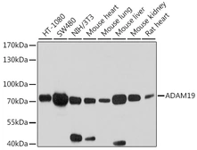 Anti-ADAM19 antibody used in Western Blot (WB). GTX64665
