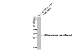 Anti-Chikungunya virus Capsid antibody [HL5731] used in Western Blot (WB). GTX646682