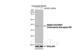 Anti-Chemokine Receptor D6 antibody [HL5734] used in Western Blot (WB). GTX646685