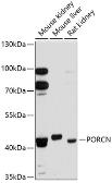 Anti-PORCN antibody used in Western Blot (WB). GTX64669