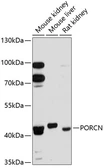 Anti-PORCN antibody used in Western Blot (WB). GTX64669