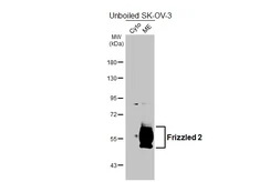 Anti-Frizzled 2 antibody [HL5743] used in Western Blot (WB). GTX646694