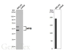 Anti-NFIB antibody [HL5754] used in Western Blot (WB). GTX646705