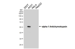 Anti-alpha 1 Antichymotrypsin antibody [HL5759] used in Western Blot (WB). GTX646710