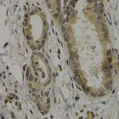 Anti-MAGE 1 antibody used in IHC (Paraffin sections) (IHC-P). GTX64672