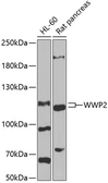 Anti-AIP2 antibody used in Western Blot (WB). GTX64673