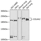 Anti-COL4A2 antibody used in Western Blot (WB). GTX64674