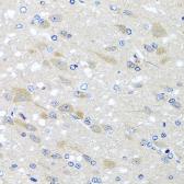 Anti-NDUFS3 antibody used in IHC (Paraffin sections) (IHC-P). GTX64675