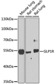Anti-GLP1R antibody used in Western Blot (WB). GTX64676